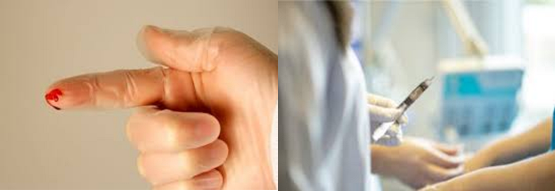 finger with blood and person holding medical needle
