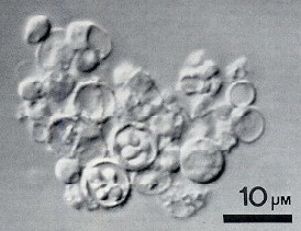 Cyst forms scanning