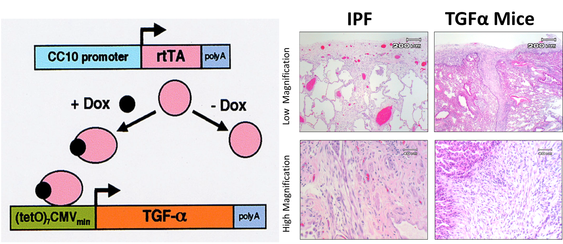 Image of Fibrosis Model