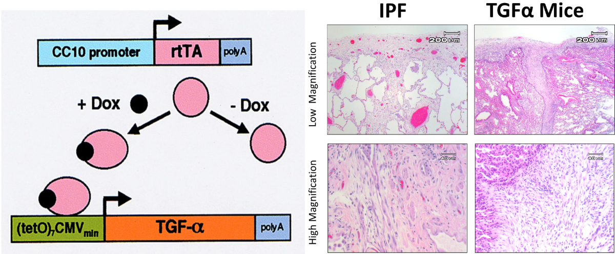 Image of Fibrosis Model