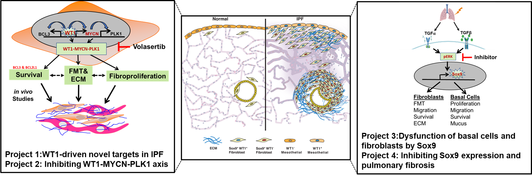 Image depiction of Pulmonary Fibrosis