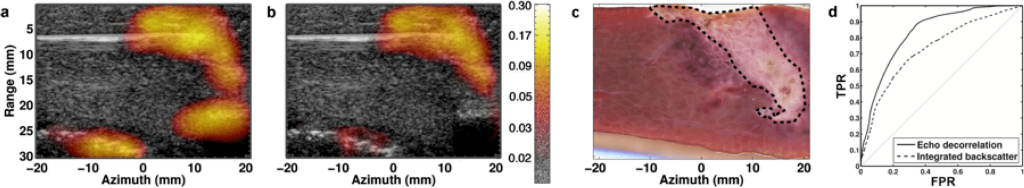 echodecorrelationfigure